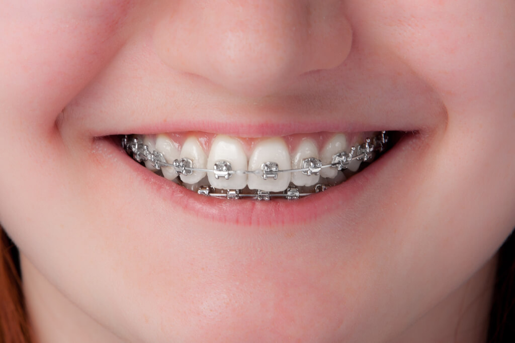 北九州市八幡東区・ばん歯科・矯正歯科・乳歯のむし歯の放置は歯並びにも影響します