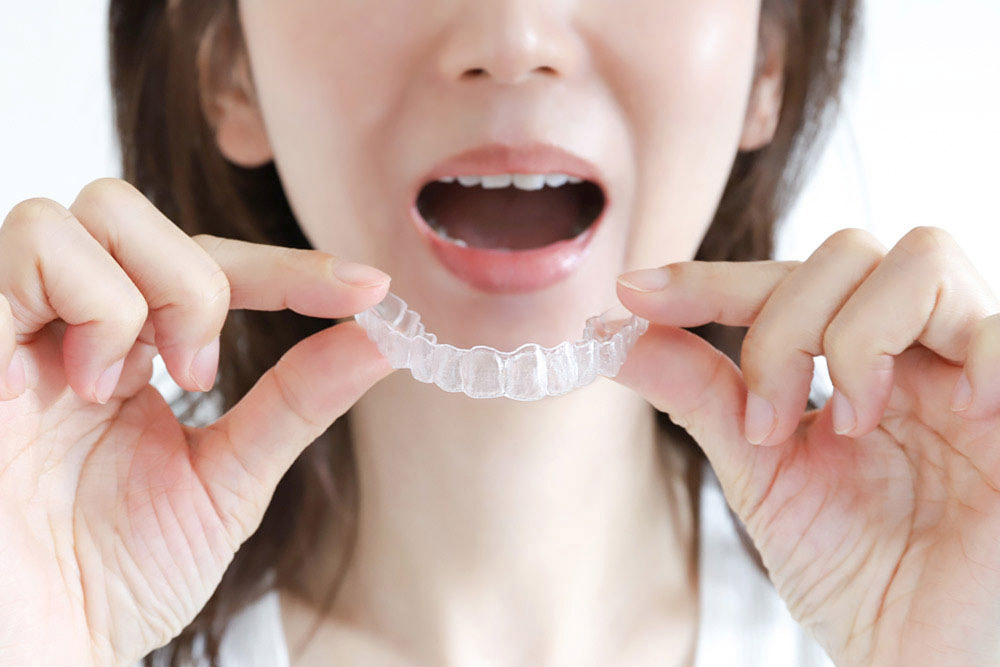 マウスピース矯正とは