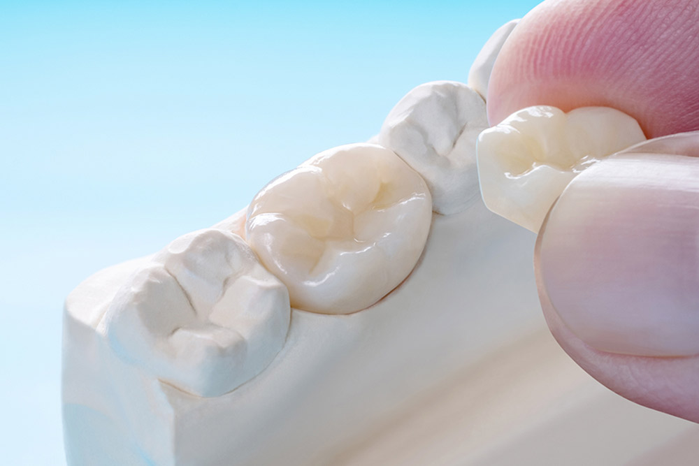 補綴物が取れた